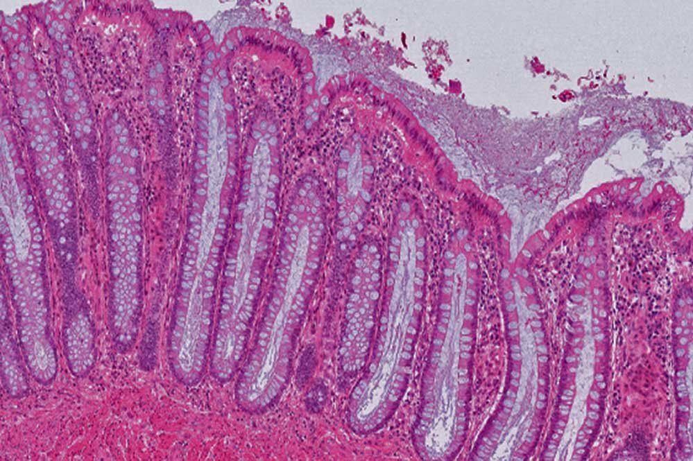 Histologie des menschlichen Darms mit Stammzellnischen. Bild: Creative Commons